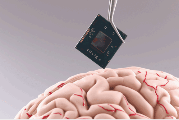 What Are the Ethical Implications of Brain-Computer Interfaces?